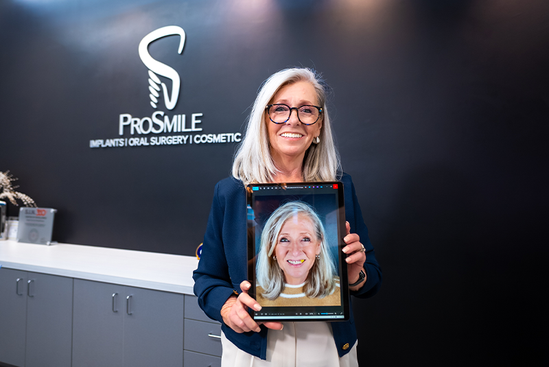 ProSmile patient Deanne smiling with her before photo from AOX procedure